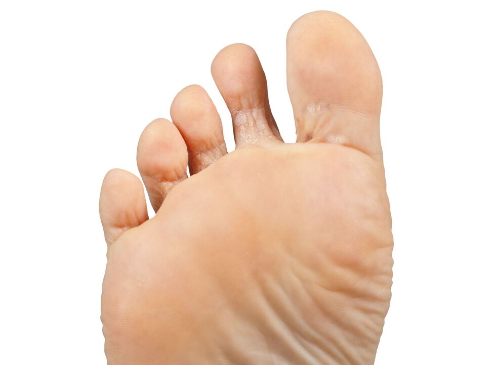 Funger-Good-and-Pair-and-Hectic-Cream-Demyxil