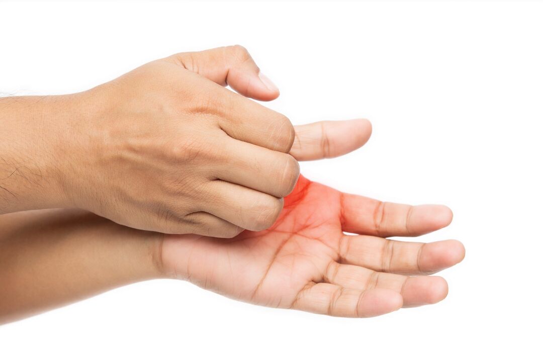 itching with fungus and treatment with zxcvbnmqwert cream with cream